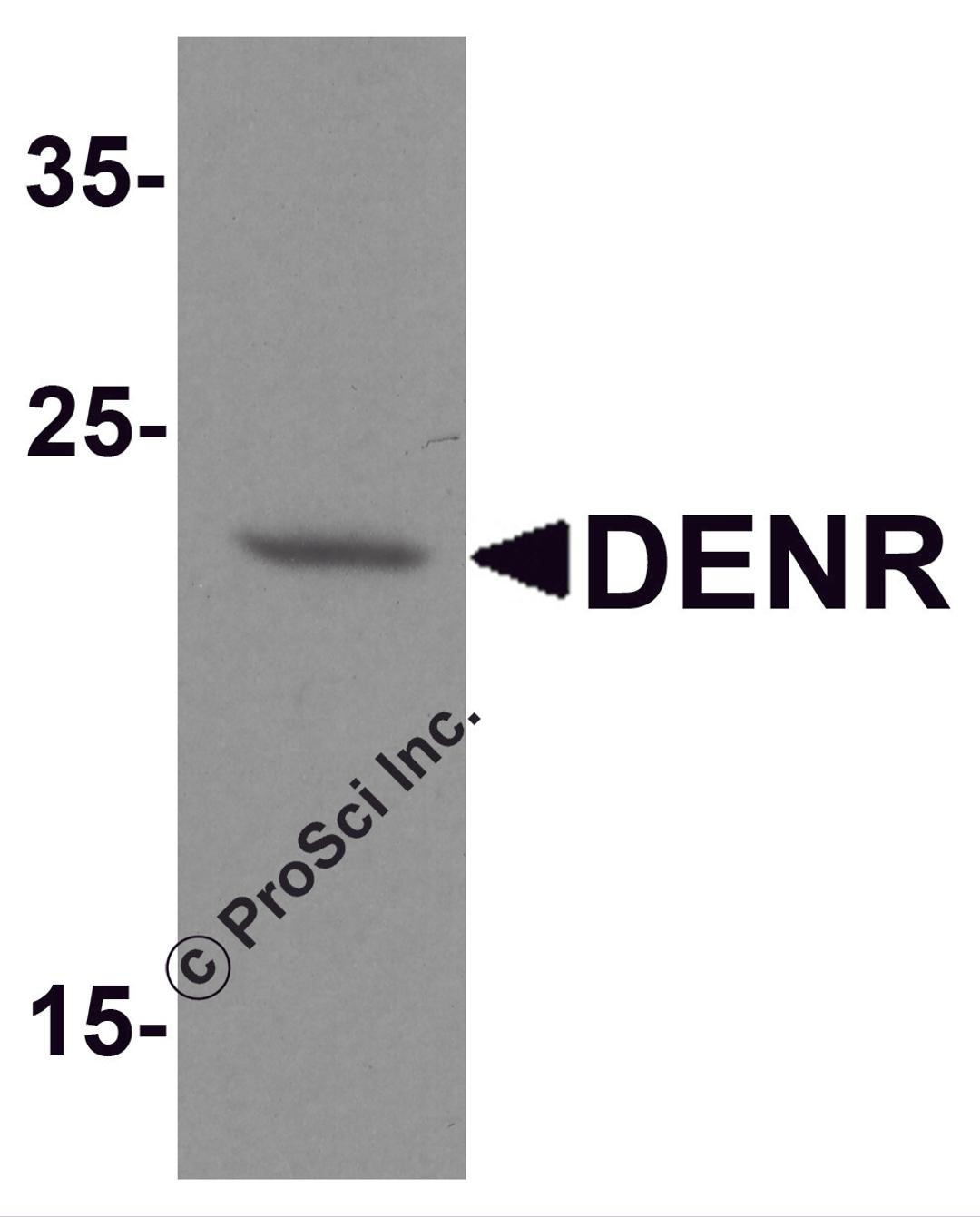 Western blot analysis of DENR in human brain tissue lysate with DENR antibody at 1 μg/ml.