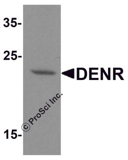 Western blot analysis of DENR in human brain tissue lysate with DENR antibody at 1 μg/ml.
