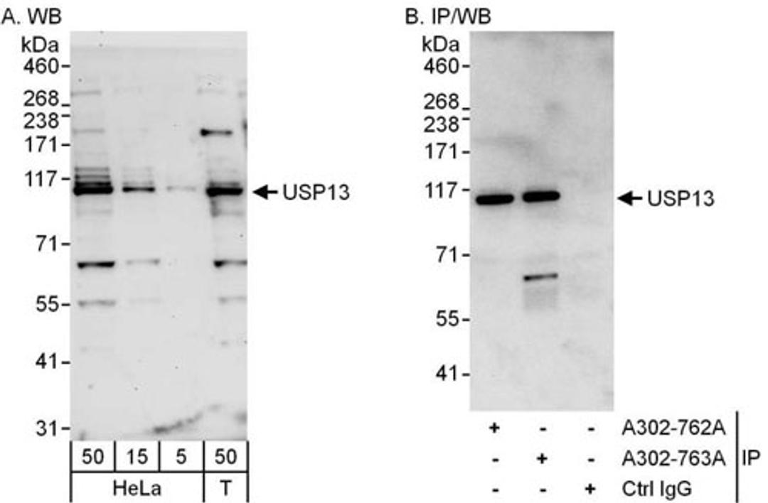 Detection of human USP13 by WB and IP.