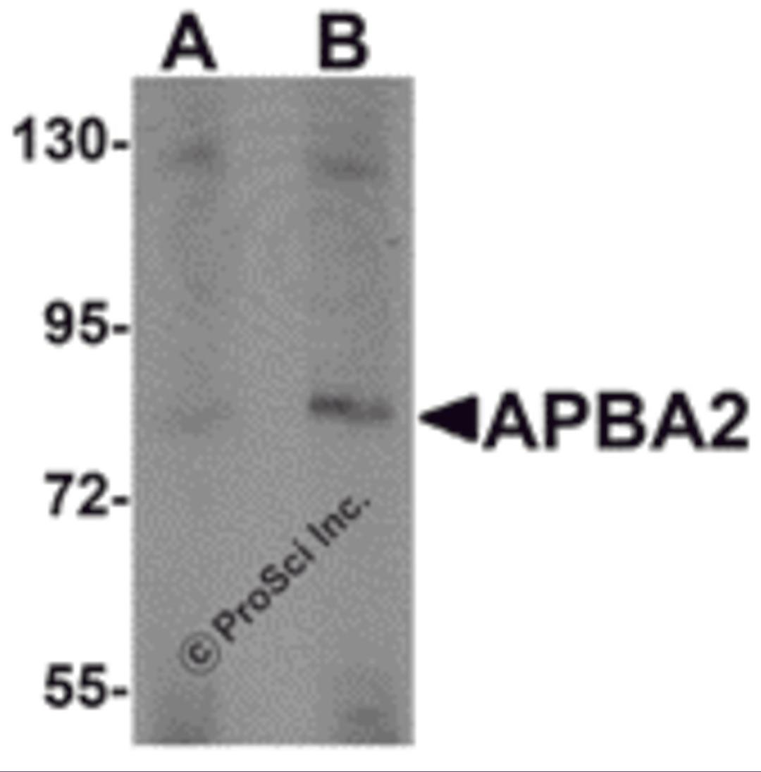 Western blot analysis of APBA2 in human brain tissue lysate with APBA2 antibody at (A) 1 and (B) 2 &#956;g/mL.