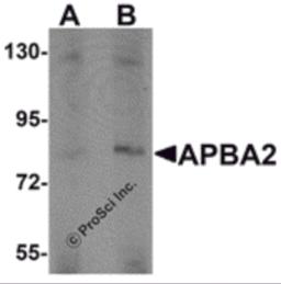 Western blot analysis of APBA2 in human brain tissue lysate with APBA2 antibody at (A) 1 and (B) 2 &#956;g/mL.