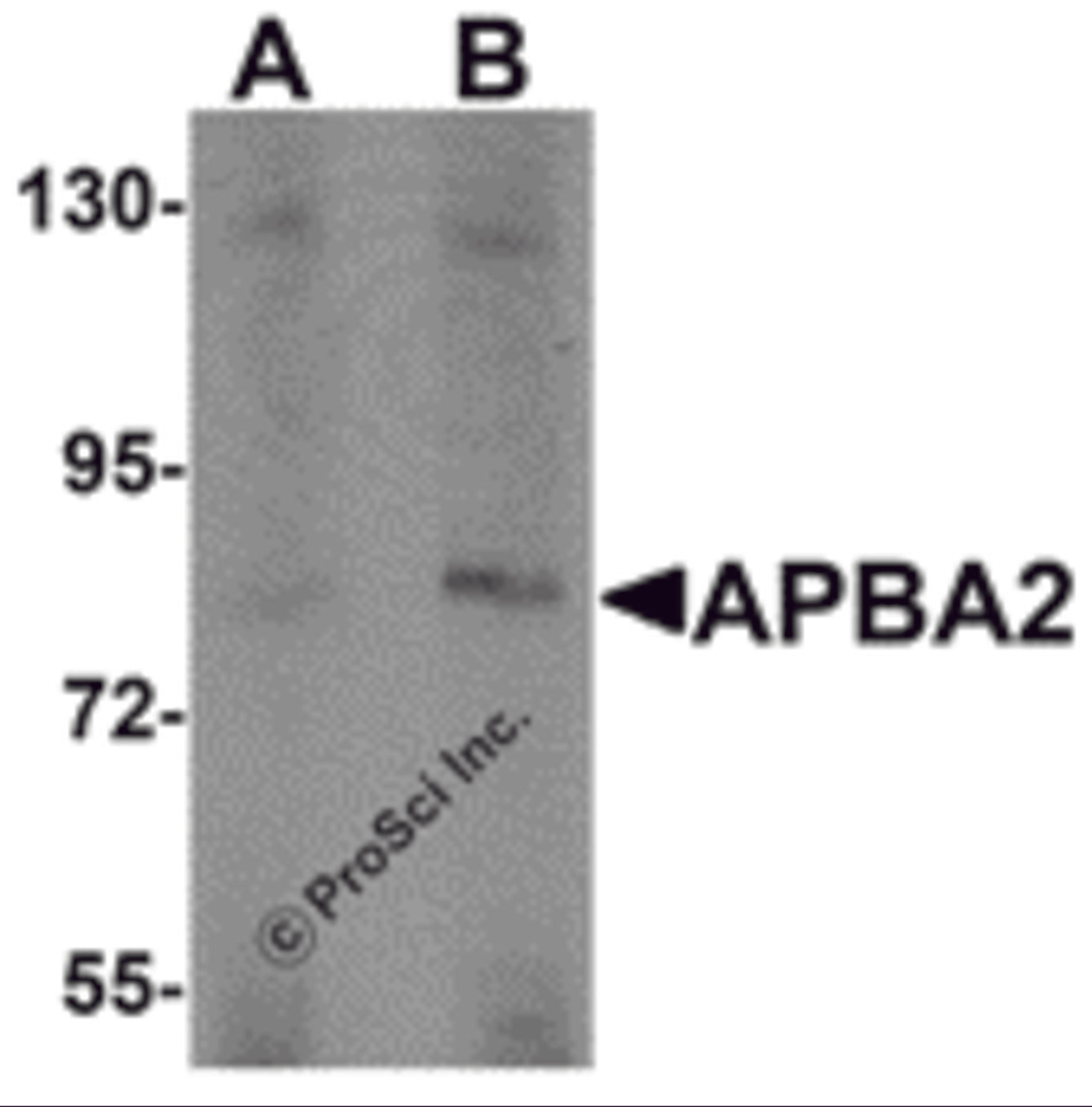 Western blot analysis of APBA2 in human brain tissue lysate with APBA2 antibody at (A) 1 and (B) 2 &#956;g/mL.