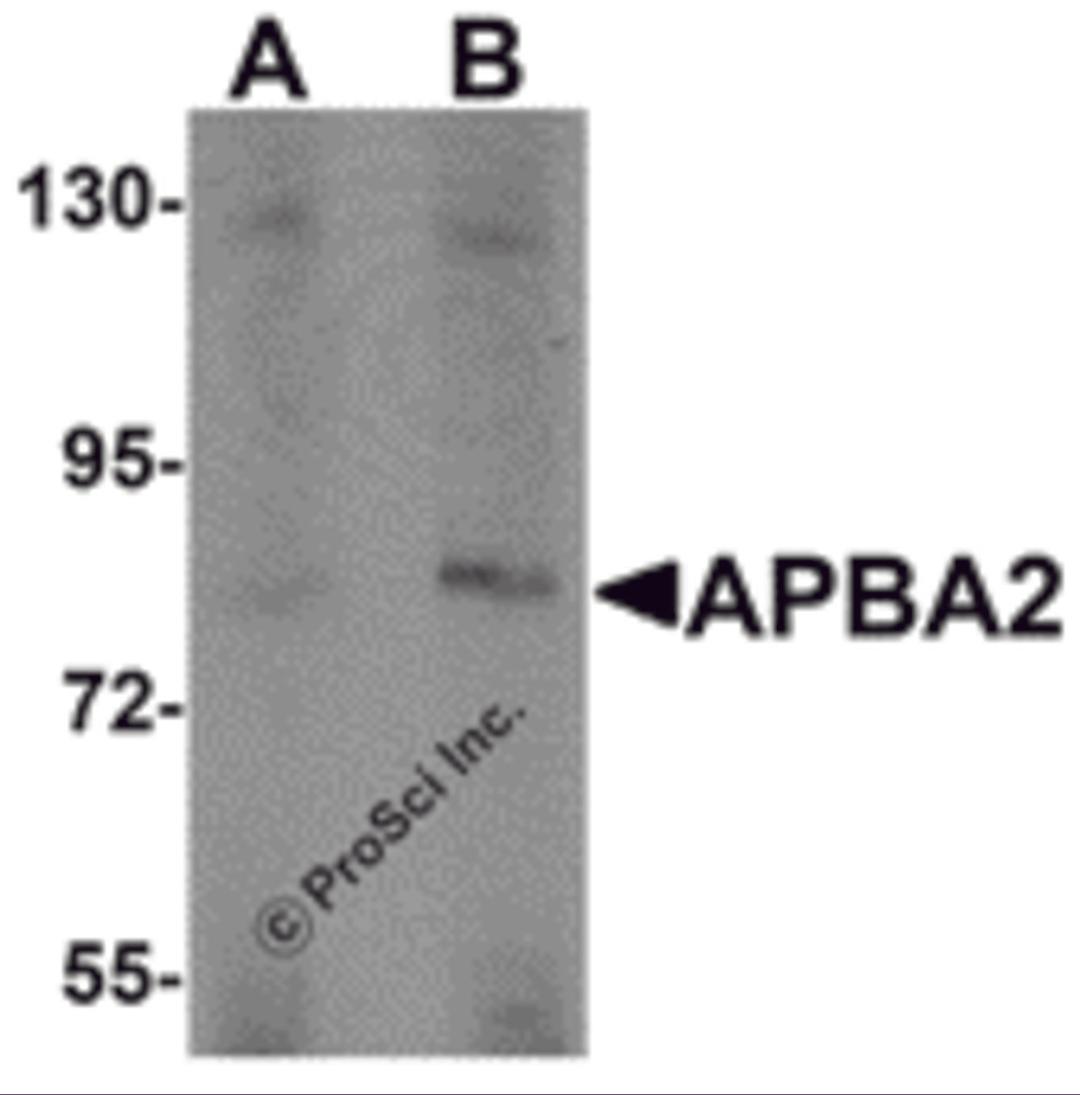 Western blot analysis of APBA2 in human brain tissue lysate with APBA2 antibody at (A) 1 and (B) 2 μg/mL.