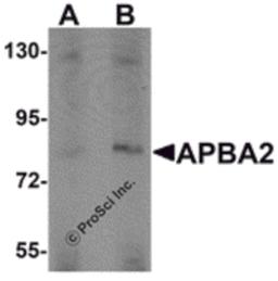 Western blot analysis of APBA2 in human brain tissue lysate with APBA2 antibody at (A) 1 and (B) 2 μg/mL.