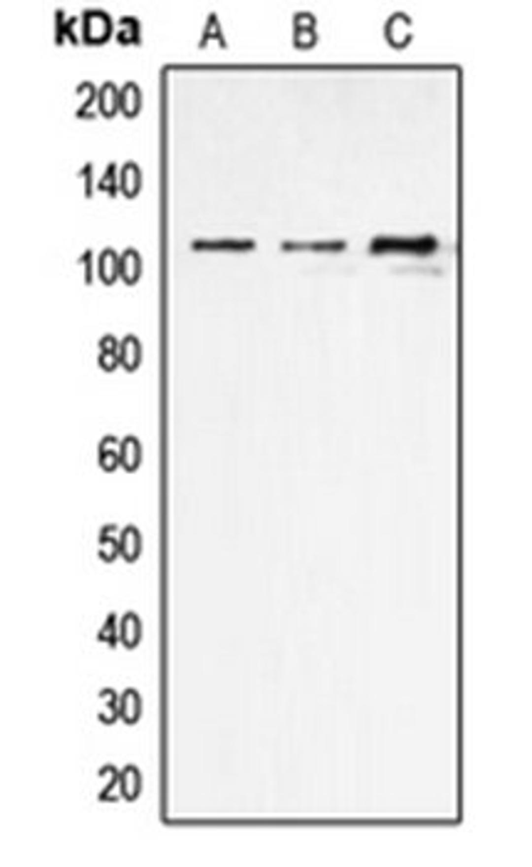 Western blot analysis of THP1 (Lane 1), NIH3T3 (Lane 2), rat kidney (Lane 3) whole cell lysates using ERAP1 antibody