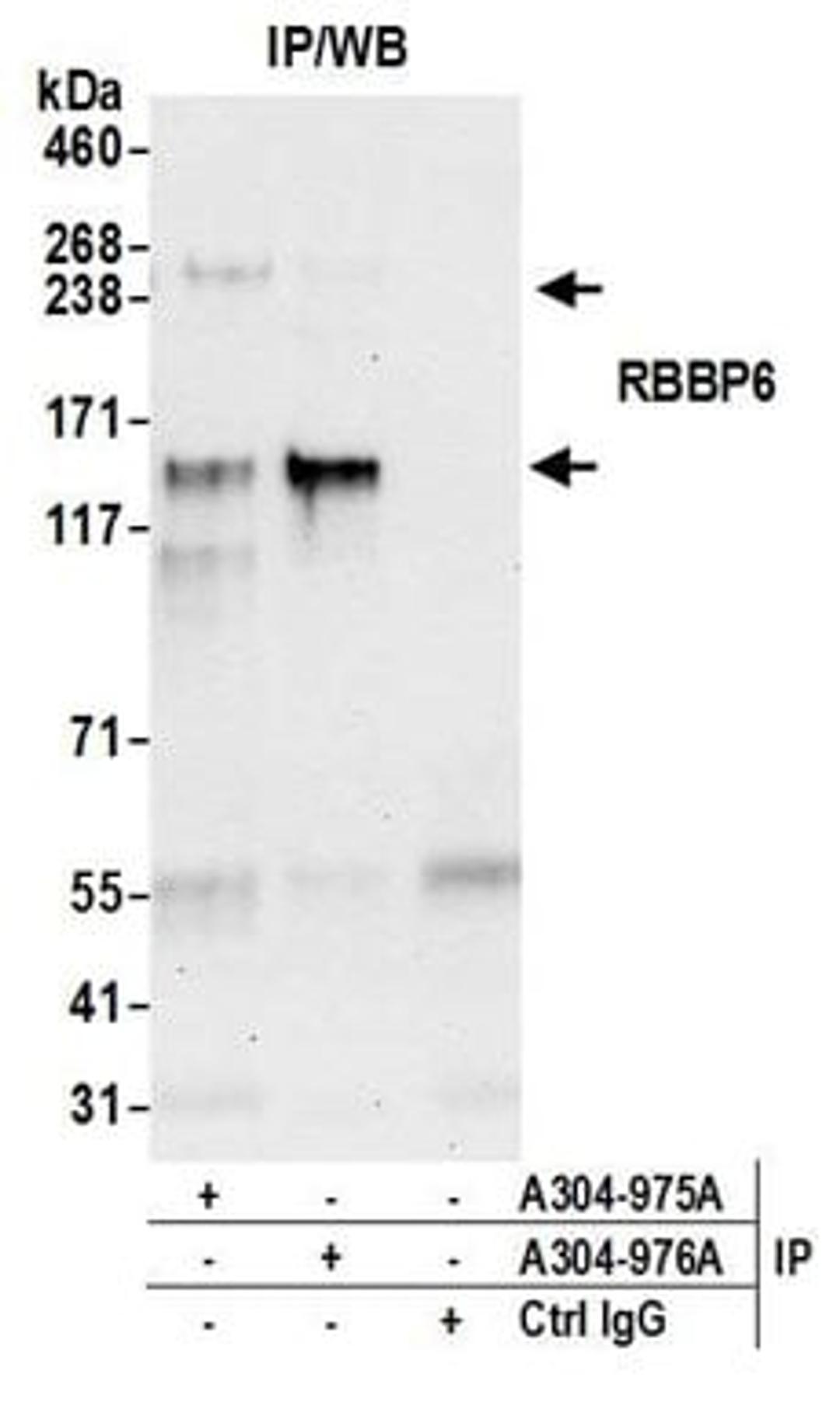 Detection of human RBBP6 by western blot of immunoprecipitates.