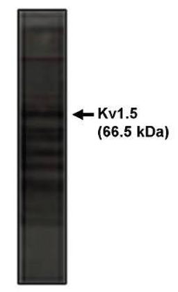 Western blot analysis of rat brain lysate using Kv1.5 Potassium Channel antibody