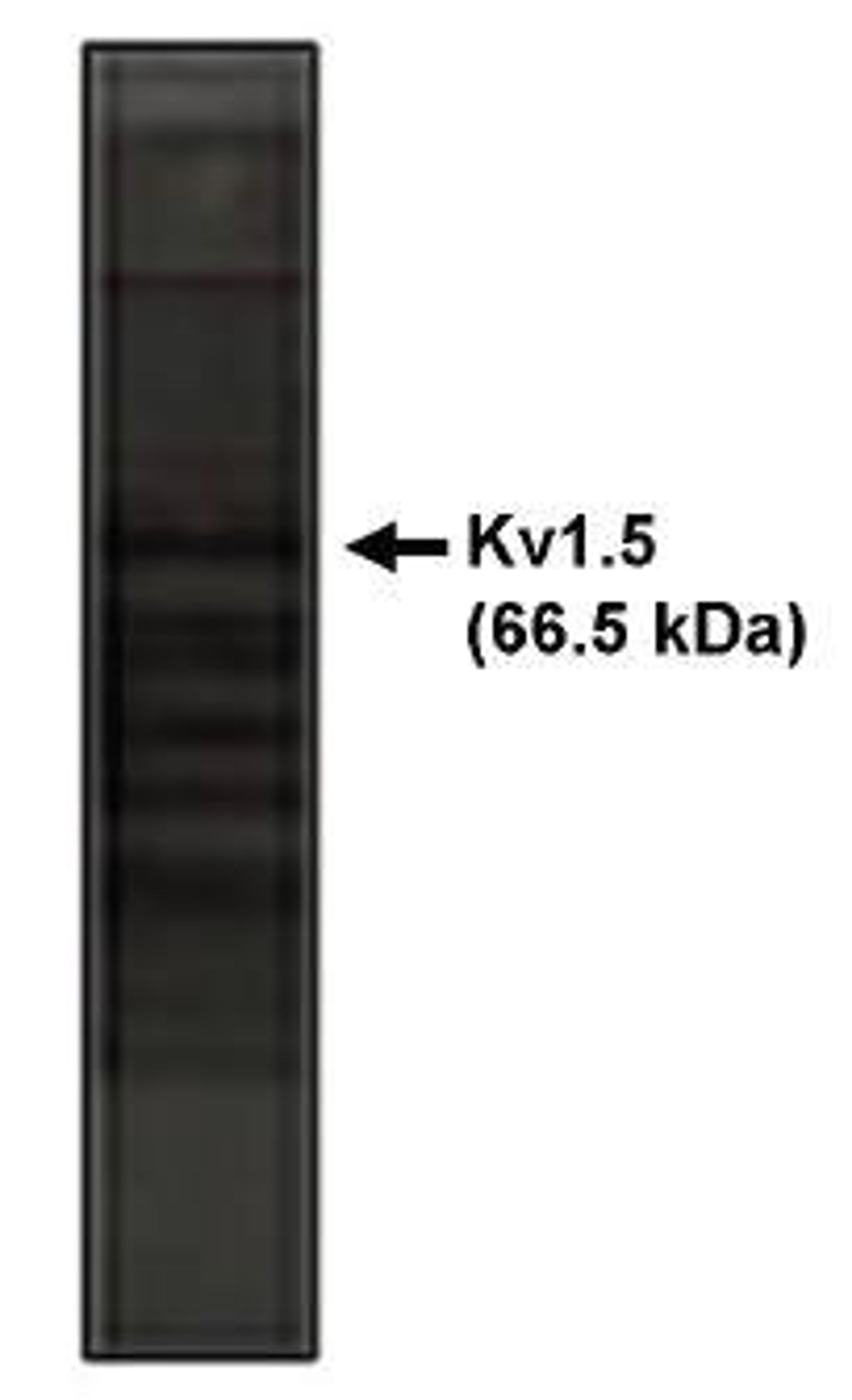 Western blot analysis of rat brain lysate using Kv1.5 Potassium Channel antibody