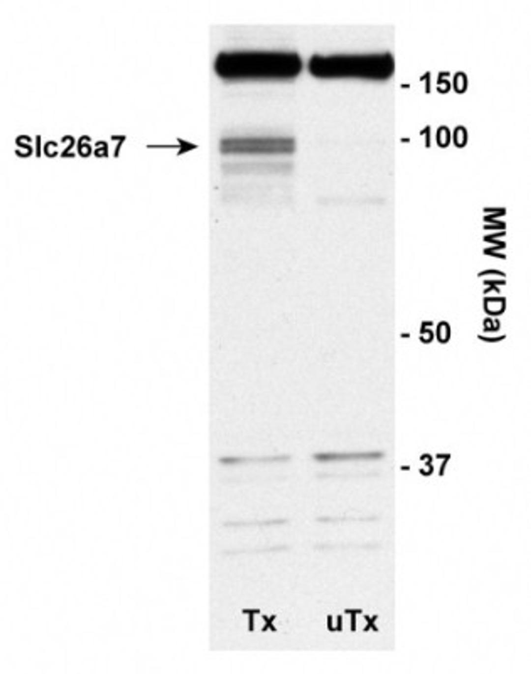 Western Blot: SLC26A7 Antibody (14H5) [NB110-60965] - Detection of Slc26a7 using NB110-60965. Tx: Okp cells transiently transfected with mouse Slc26a7 UTX: untransfected Okp cells.