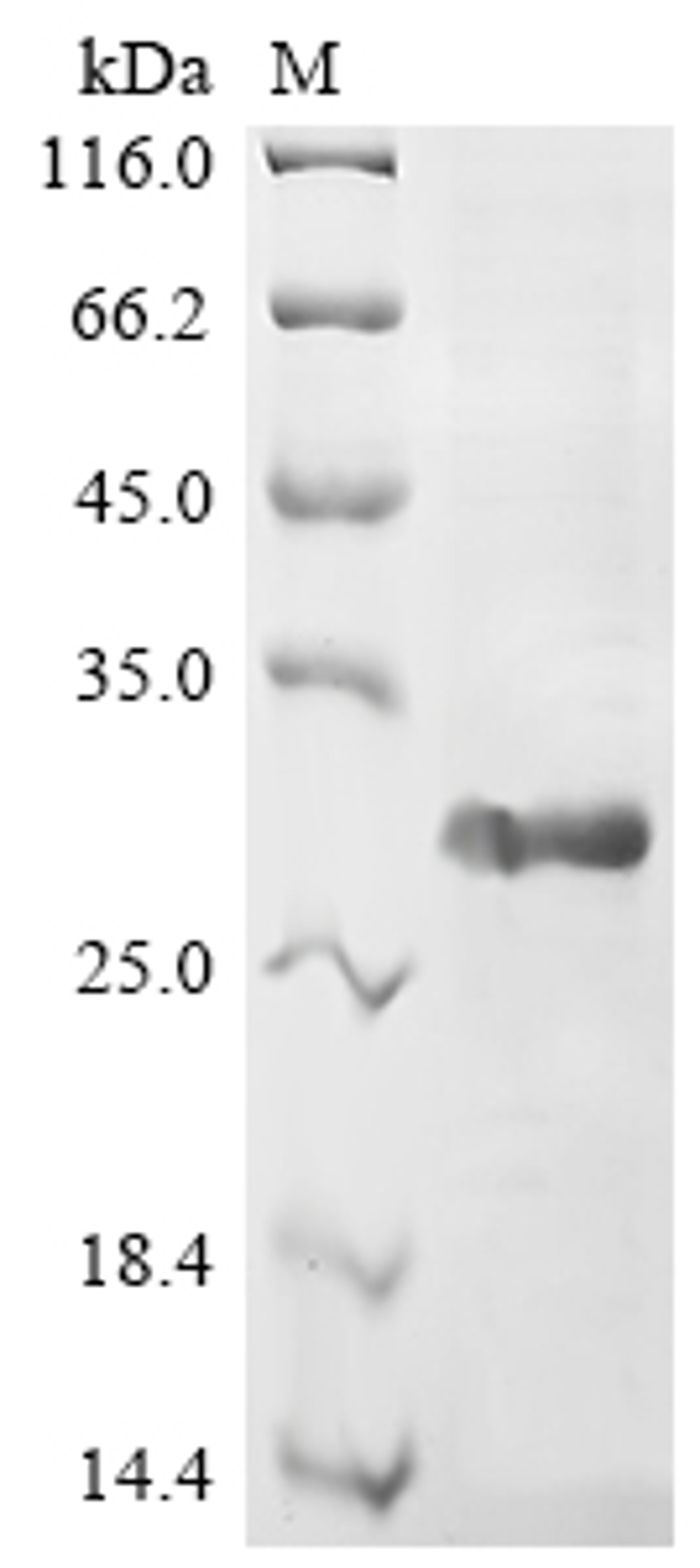 (Tris-Glycine gel) Discontinuous SDS-PAGE (reduced) with 5% enrichment gel and 15% separation gel.
