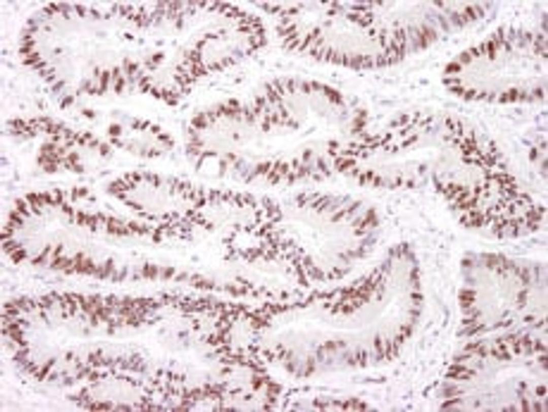 Detection of human DNA-PKcs by immunohistochemistry.