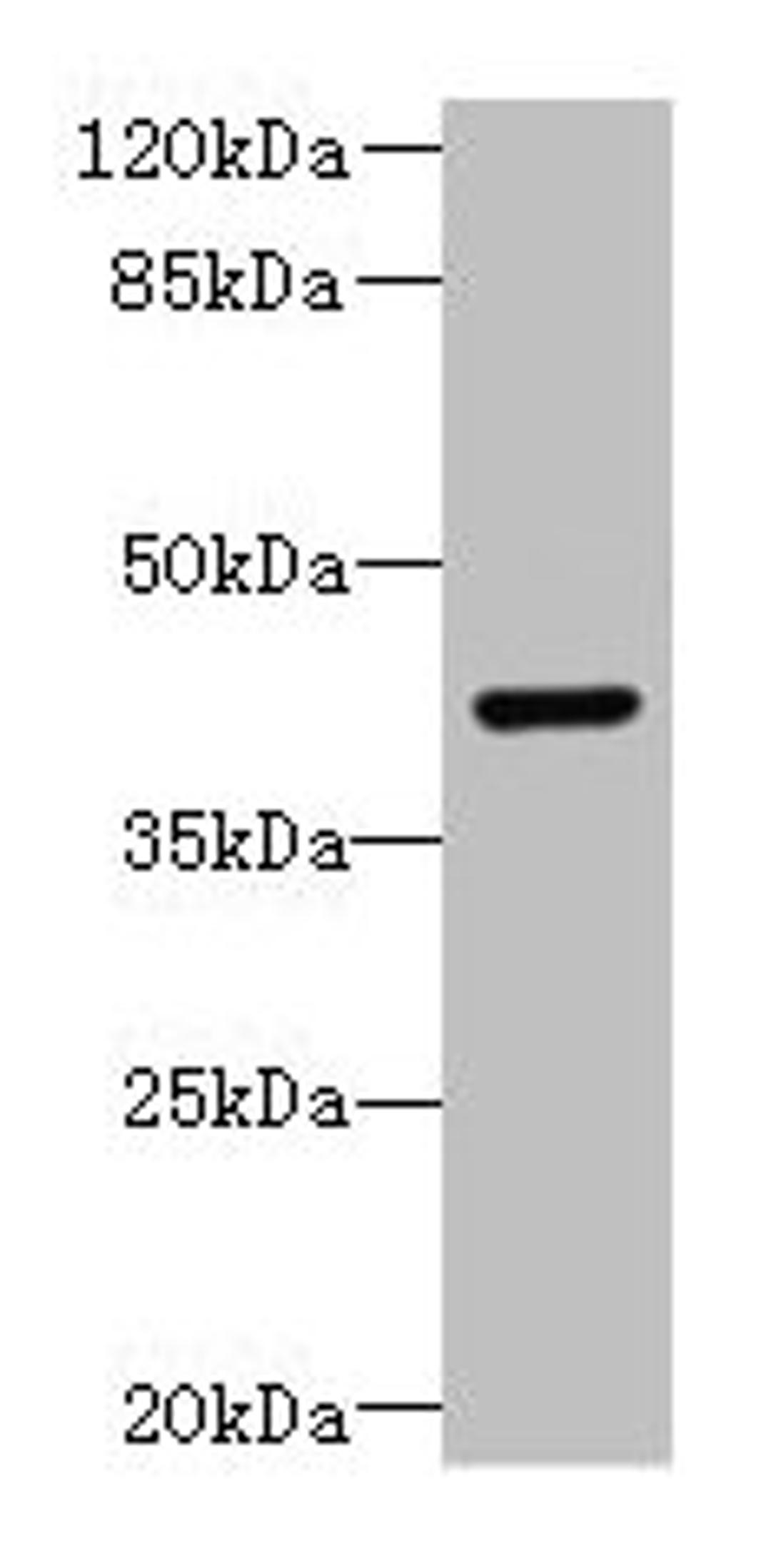 Western blot. All lanes: DCX antibody at 8µg/ml + Mouse brain tissue. Secondary. Goat polyclonal to rabbit IgG at 1/10000 dilution. Predicted band size: 41 kDa. Observed band size: 41 kDa