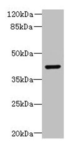 Western blot. All lanes: DCX antibody at 8µg/ml + Mouse brain tissue. Secondary. Goat polyclonal to rabbit IgG at 1/10000 dilution. Predicted band size: 41 kDa. Observed band size: 41 kDa