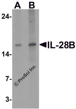 Western blot analysis of IL-28B in HeLa cell lysate with IL-28B antibody at (A) 1 and (B) 2 μg/ml.