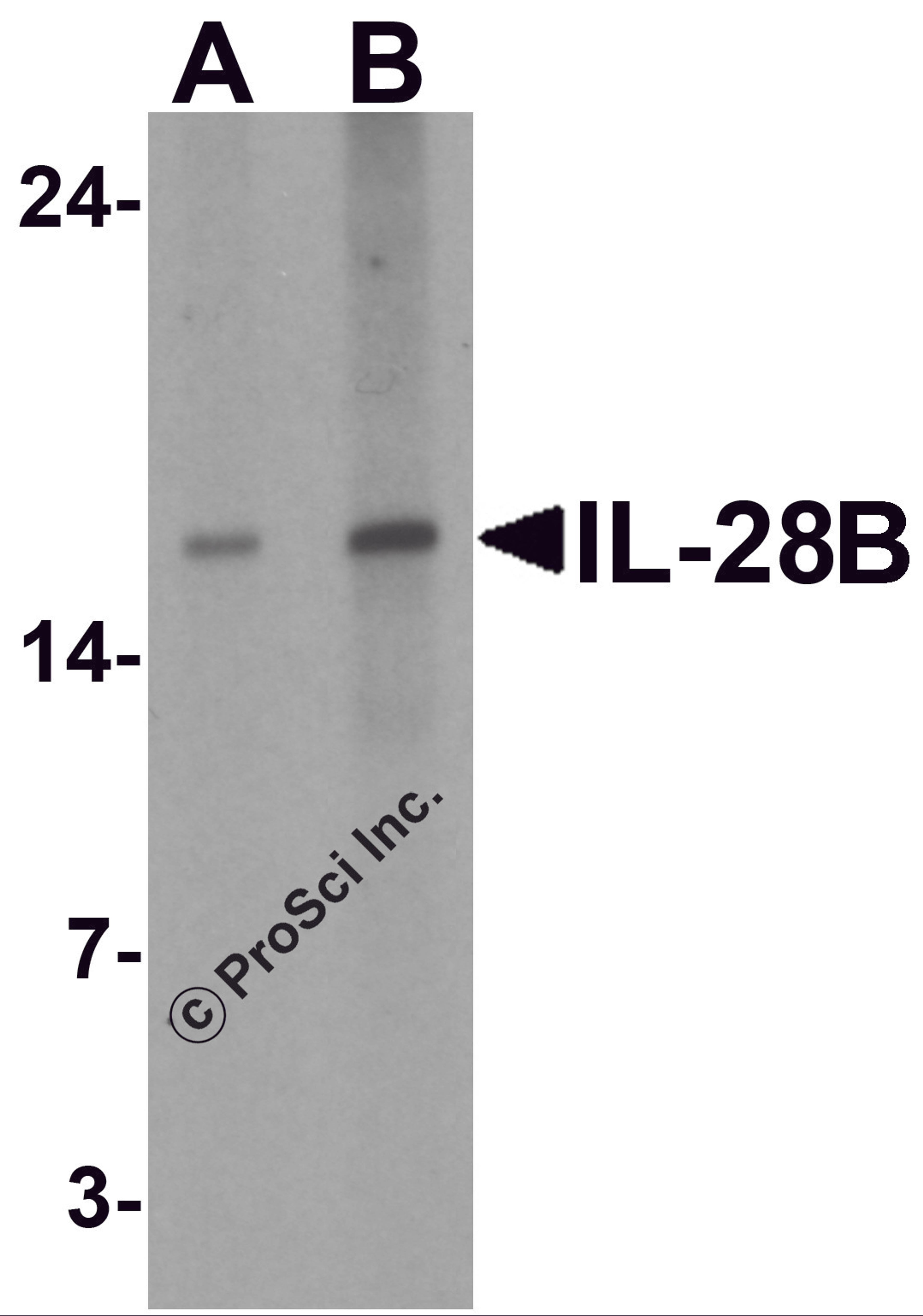 Western blot analysis of IL-28B in HeLa cell lysate with IL-28B antibody at (A) 1 and (B) 2 μg/ml.