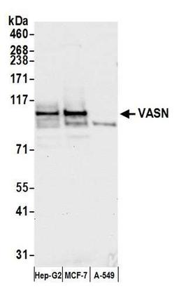 Detection of human VASN by WB.