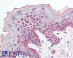 45-574 (5ug/ml) staining of paraffin embedded Human Skin. Steamed antigen retrieval with citrate buffer pH 6, AP-staining.