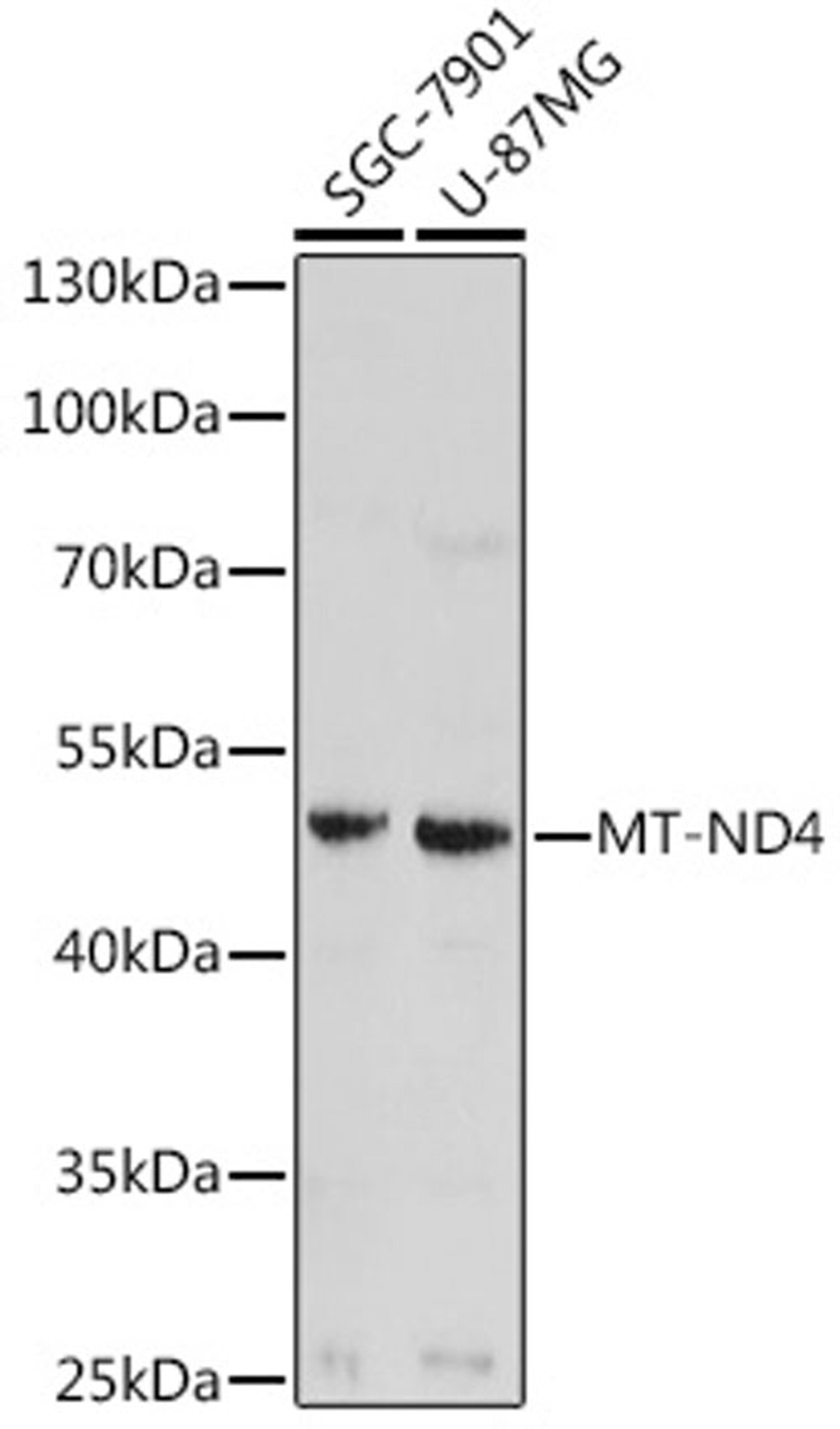 Western blot - MT-ND4 antibody (A17970)