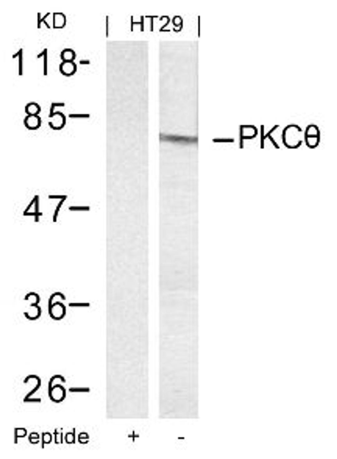 Western blot analysis of lysed extracts from HT29 cells using PKC&#920; (Ab-695).