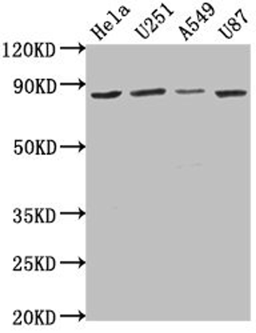 Western Blot. Positive WB detected in: Hela whole cell lysate, U251 whole cell lysate, A549 whole cell lysate, U87 whole cell lysate. All lanes: VPS51 antibody at 1:1000. Secondary. Goat polyclonal to rabbit IgG at 1/50000 dilution. Predicted band size: 87, 73 kDa. Observed band size: 87 kDa.