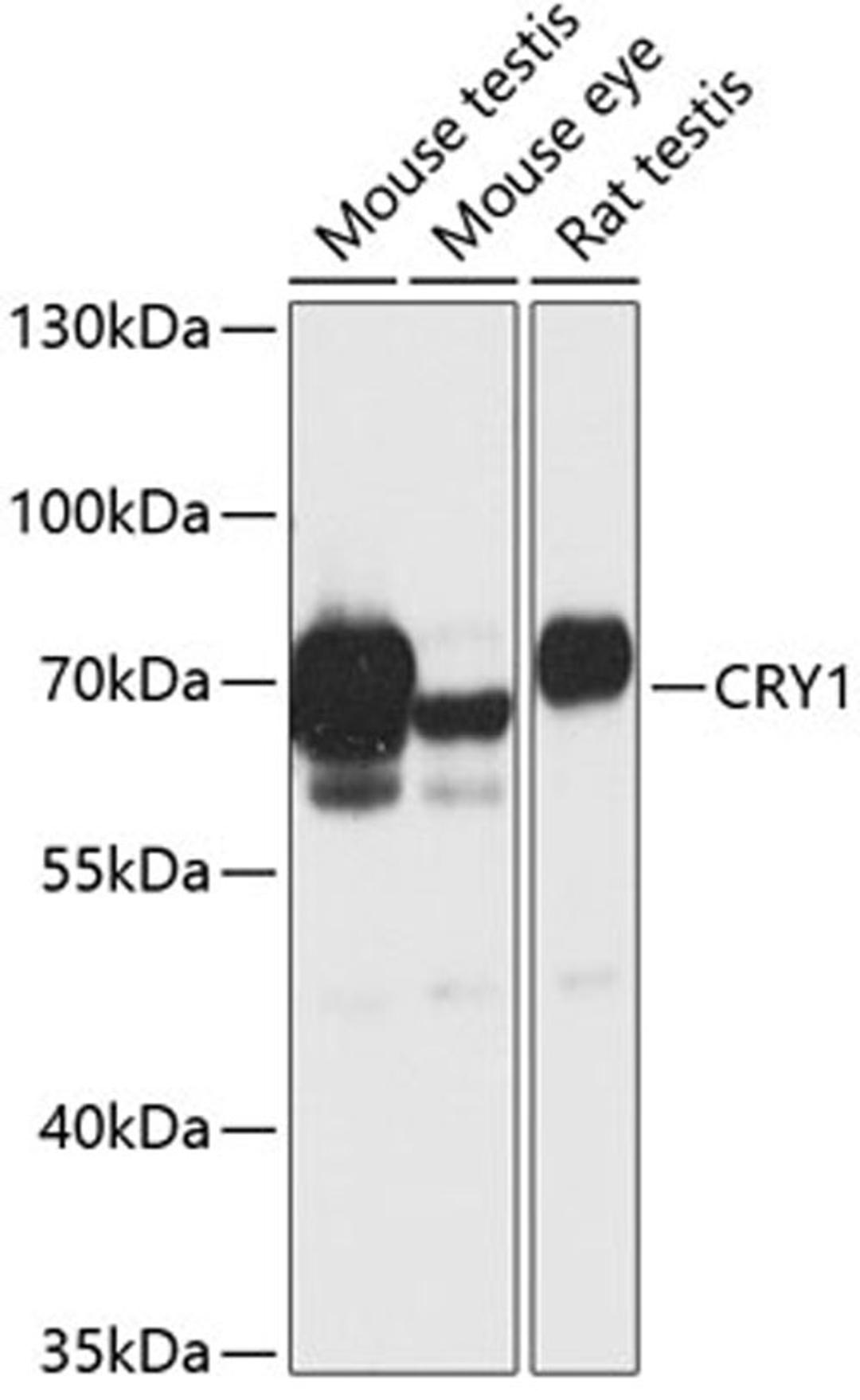 Western blot - CRY1 antibody (A13662)