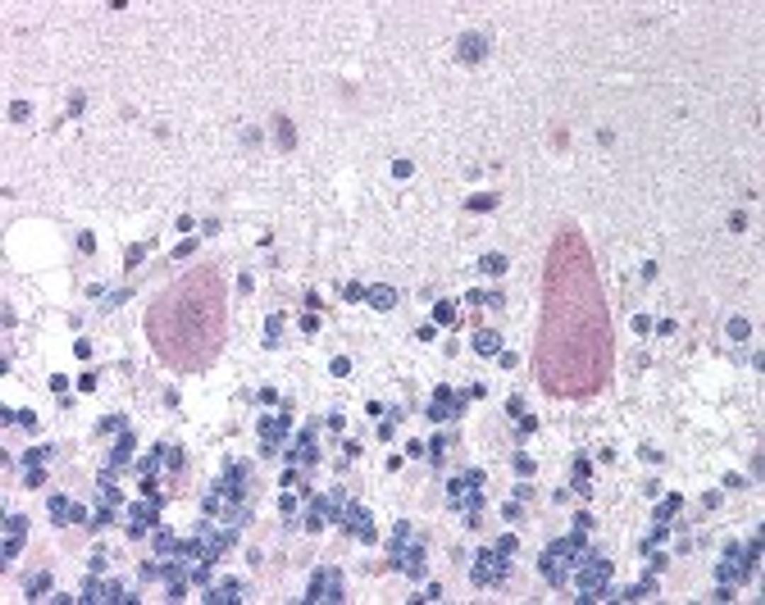 Immunohistochemistry staining of Huntingtin in brain cerebellum tissue using Huntingtin Antibody.