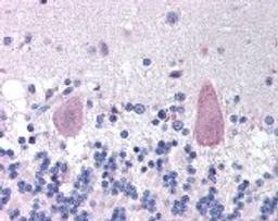 Immunohistochemistry staining of Huntingtin in brain cerebellum tissue using Huntingtin Antibody.