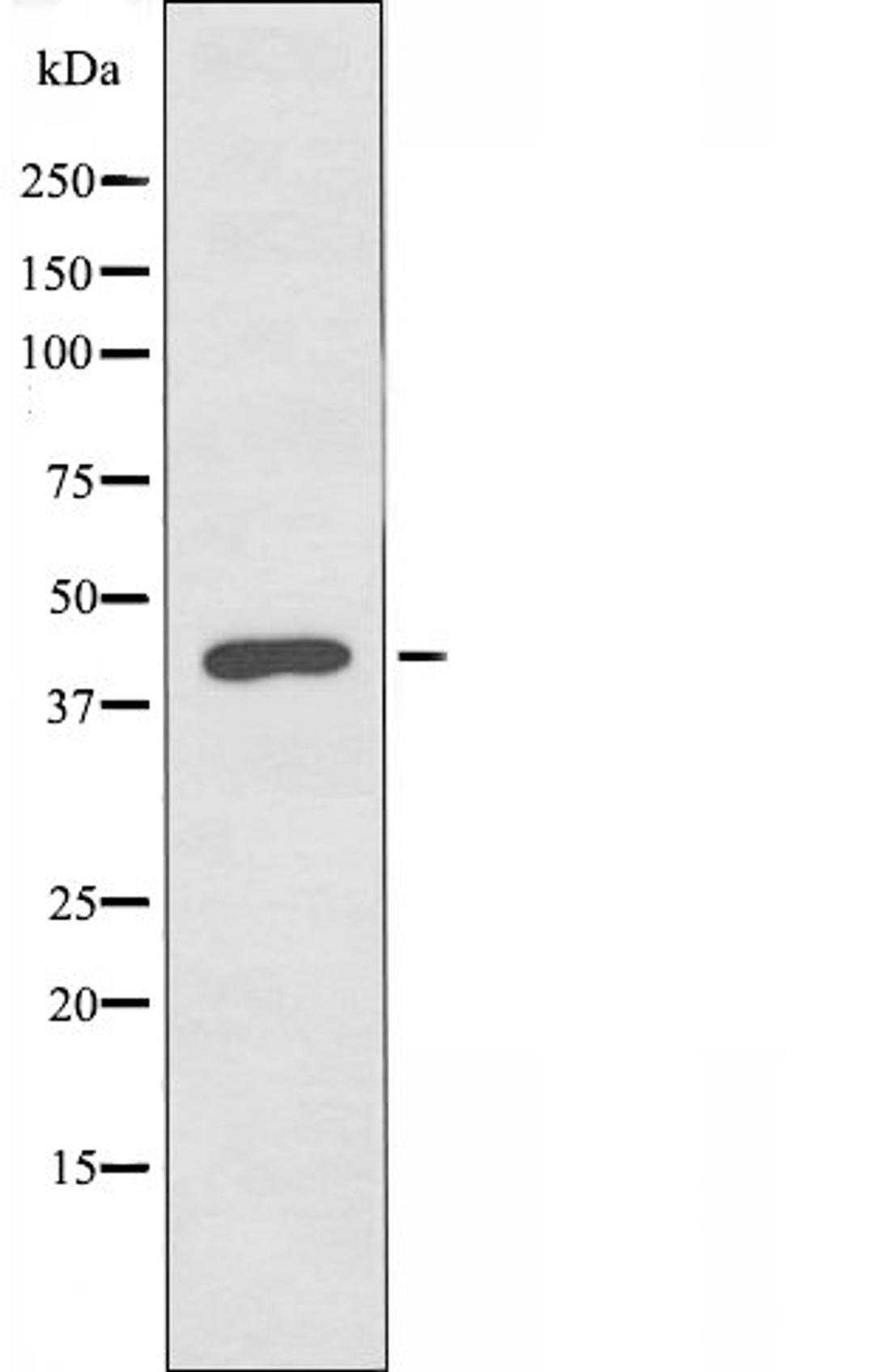 Western blot analysis of K562 cells using Prostacyclin Receptor antibody