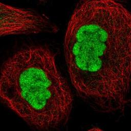 Immunocytochemistry/Immunofluorescence: METTL14 Antibody [NBP1-81392] - Staining of human cell line A-431 shows positivity in nucleus but not nucleoli.