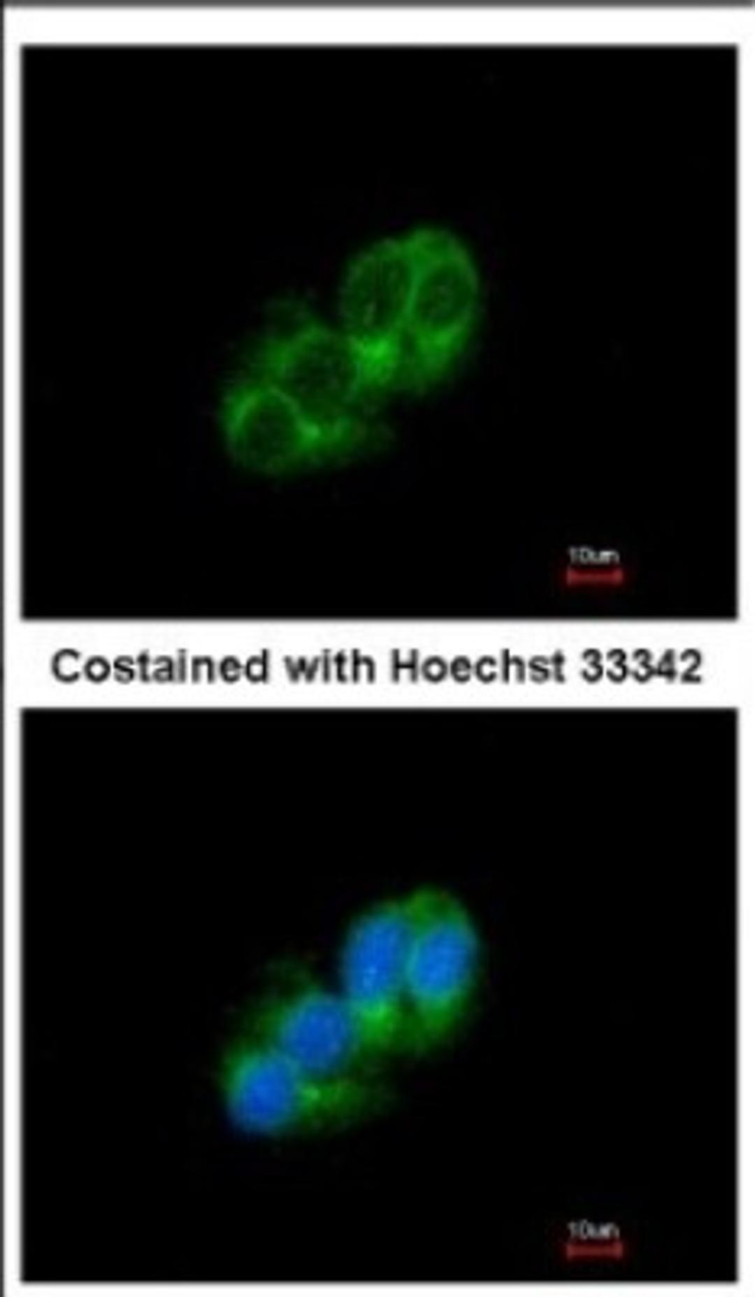 Immunocytochemistry/Immunofluorescence: STAC Antibody [NBP2-20498] - Immunofluorescence analysis of methanol-fixed HepG2, using antibody at 1:500 dilution.