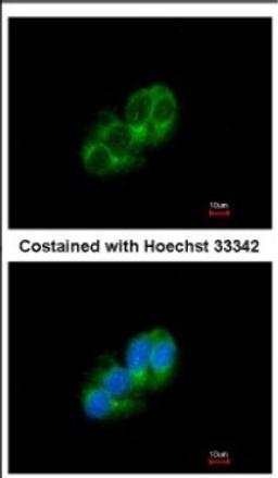 Immunocytochemistry/Immunofluorescence: STAC Antibody [NBP2-20498] - Immunofluorescence analysis of methanol-fixed HepG2, using antibody at 1:500 dilution.