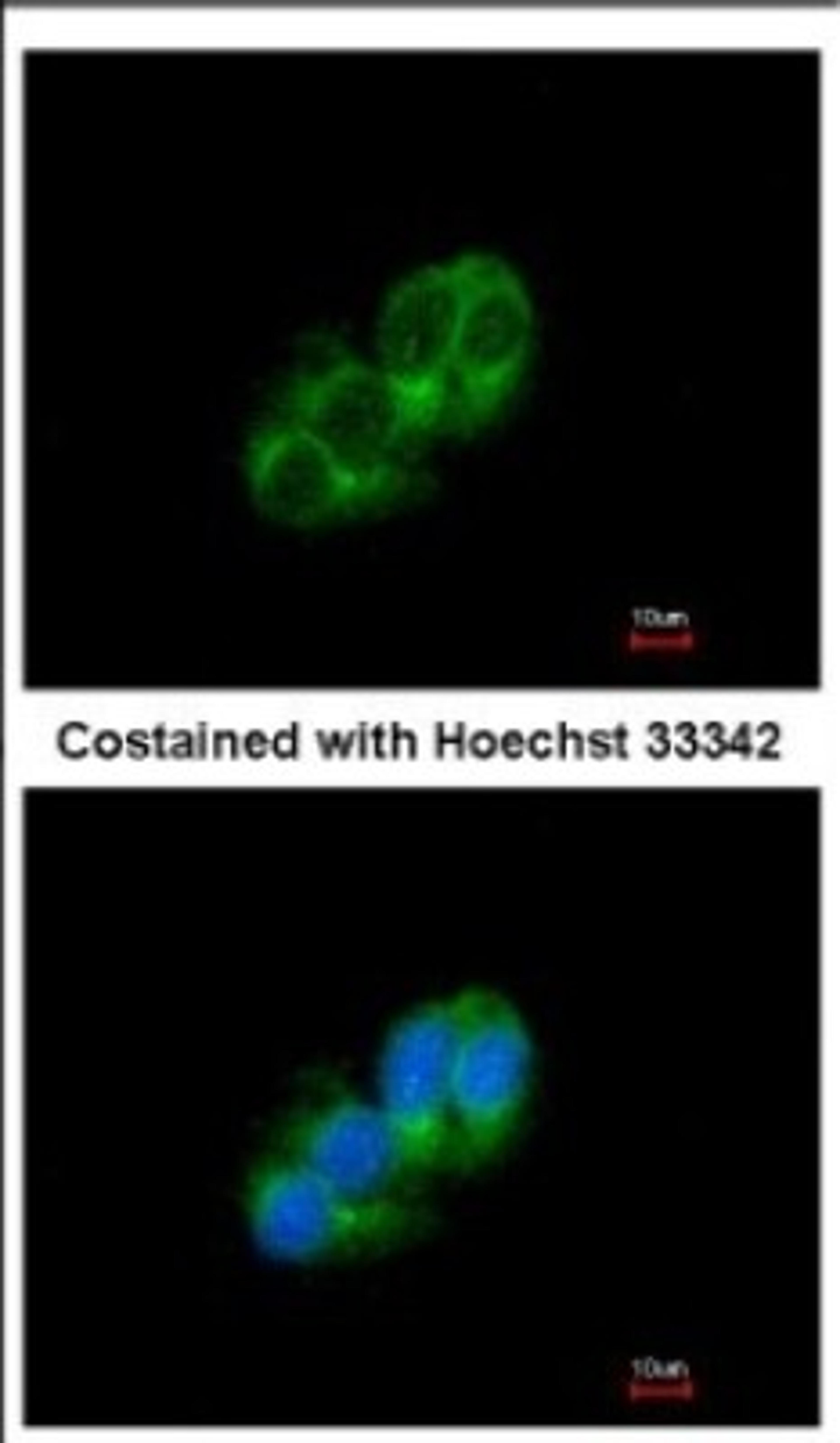 Immunocytochemistry/Immunofluorescence: STAC Antibody [NBP2-20498] - Immunofluorescence analysis of methanol-fixed HepG2, using antibody at 1:500 dilution.