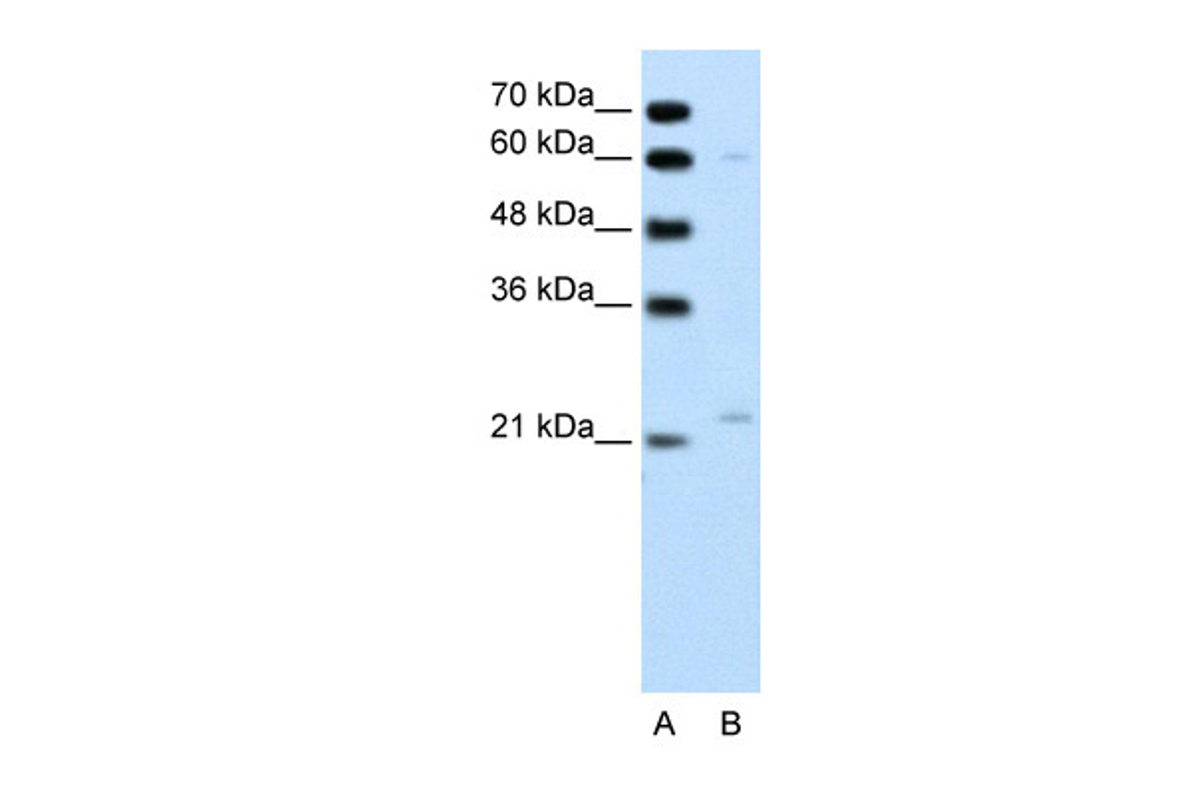 Antibody used in WB on Human Jurkat 0.2-1 ug/ml.