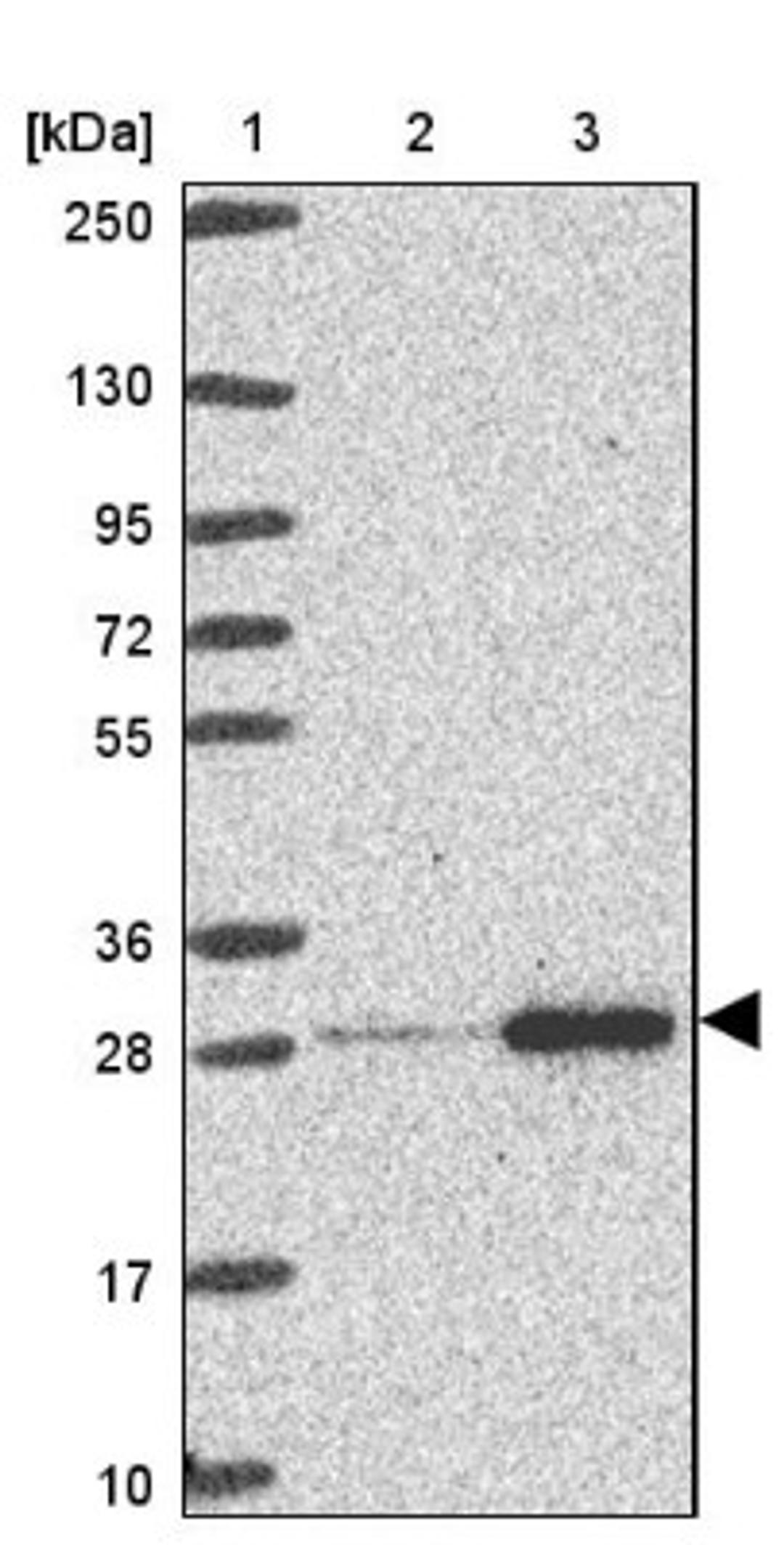 Western Blot: RPL10A Antibody [NBP2-47298] - Lane 1: Marker [kDa] 250, 130, 95, 72, 55, 36, 28, 17, 10.  Lane 2: Human cell line RT-4.  Lane 3: Human cell line U-251MG.