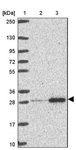 Western Blot: RPL10A Antibody [NBP2-47298] - Lane 1: Marker [kDa] 250, 130, 95, 72, 55, 36, 28, 17, 10.  Lane 2: Human cell line RT-4.  Lane 3: Human cell line U-251MG.