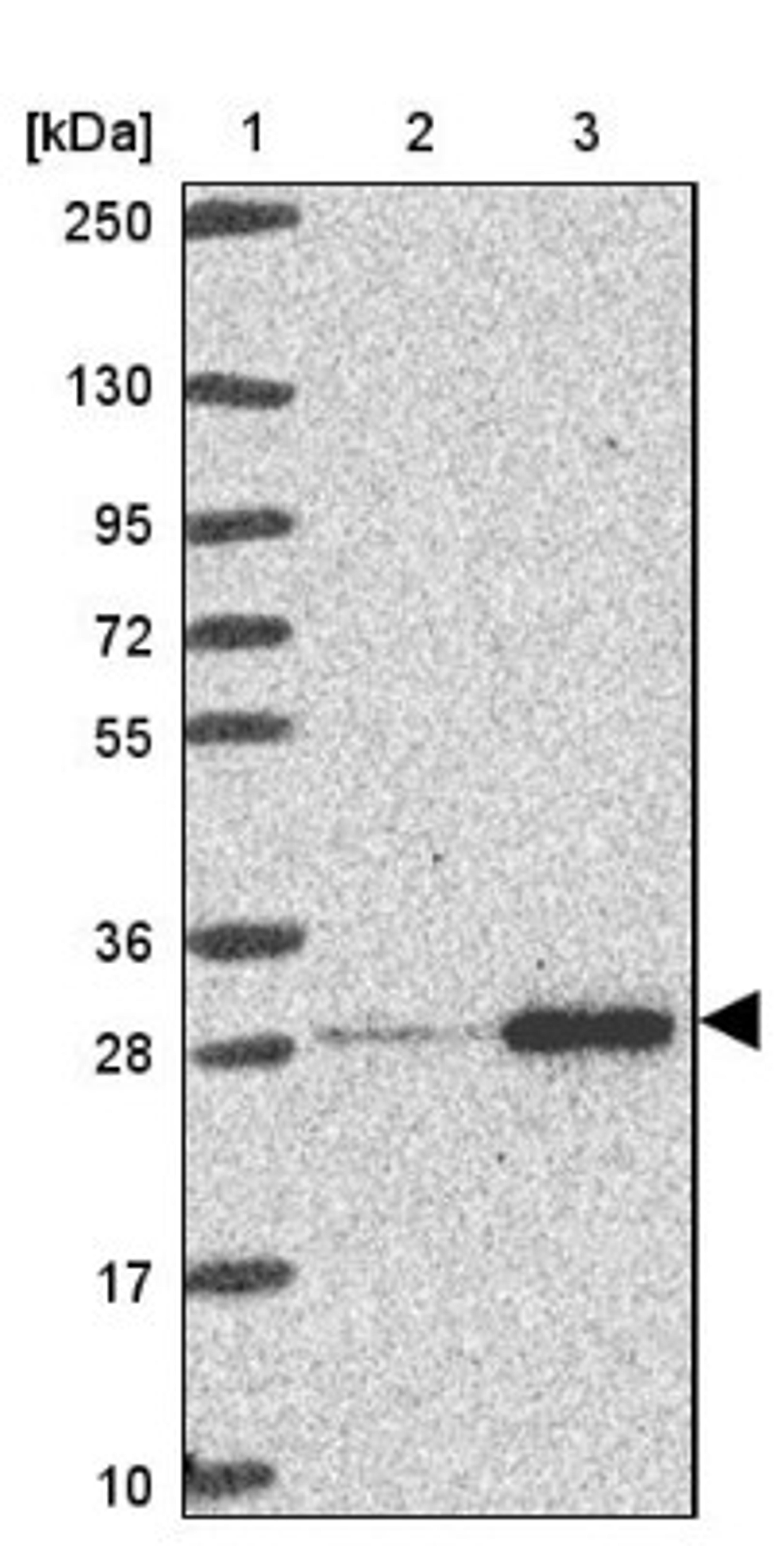 Western Blot: RPL10A Antibody [NBP2-47298] - Lane 1: Marker [kDa] 250, 130, 95, 72, 55, 36, 28, 17, 10.  Lane 2: Human cell line RT-4.  Lane 3: Human cell line U-251MG.