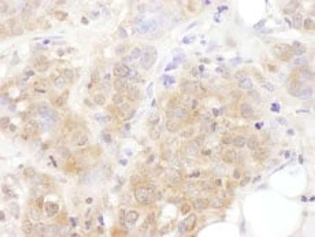 Detection of human AS160 by immunohistochemistry.