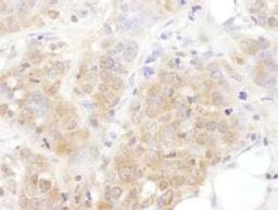 Detection of human AS160 by immunohistochemistry.