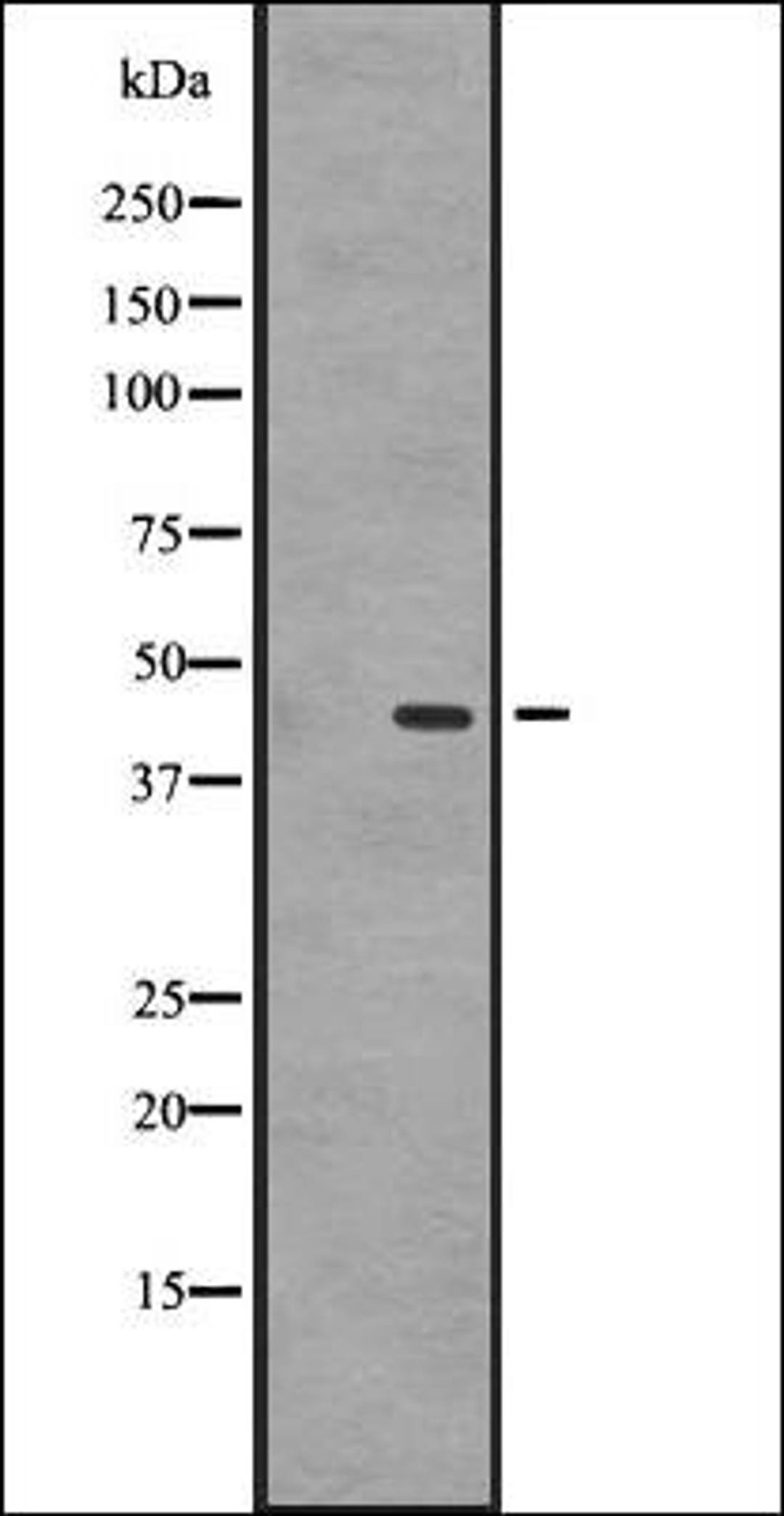 Western blot analysis of A431 whole cell lysate using GPR87/GPR95 antibody