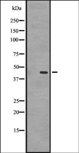 Western blot analysis of A431 whole cell lysate using GPR87/GPR95 antibody