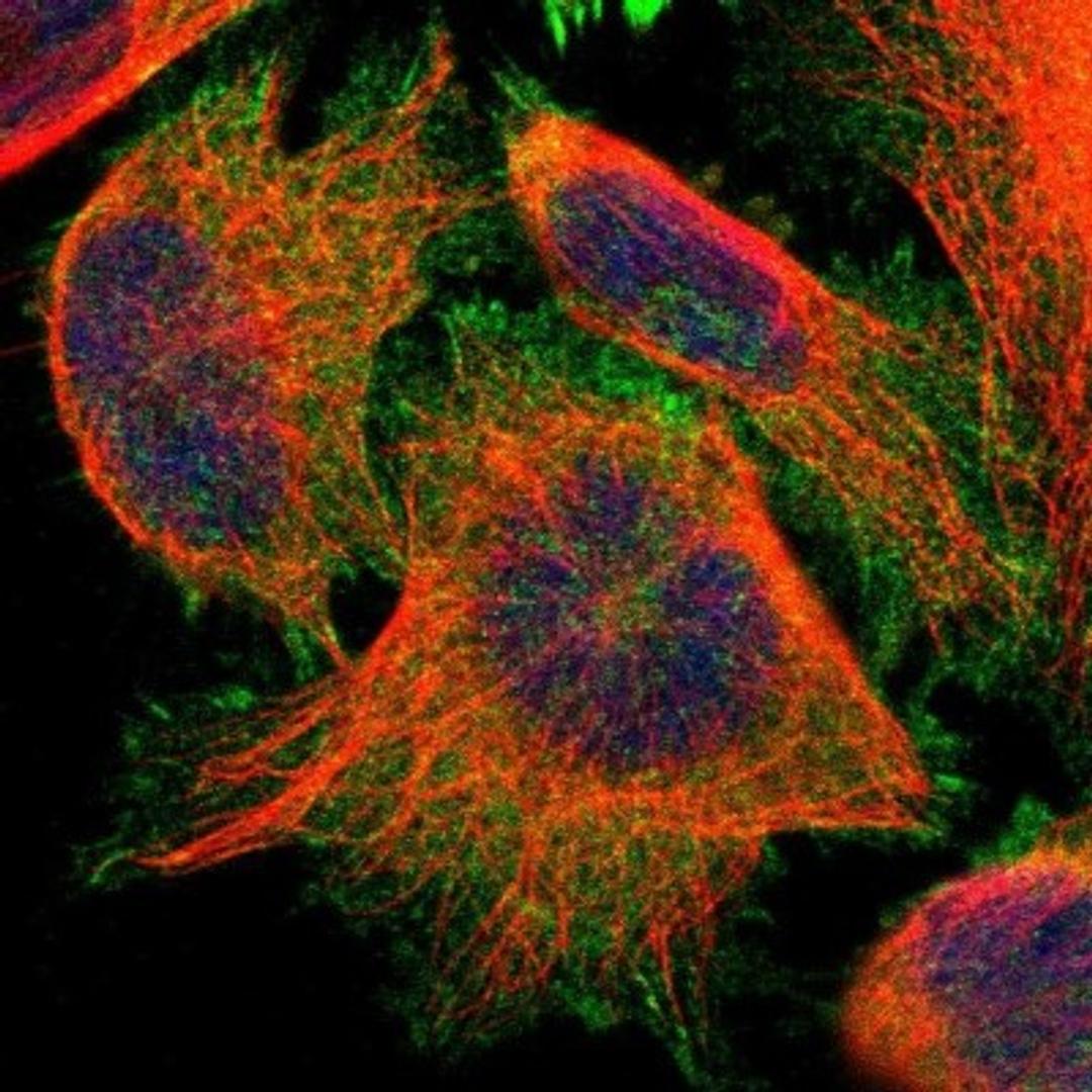 Immunocytochemistry/Immunofluorescence: PDLIM5 Antibody [NBP1-84843] - Staining of human cell line U-251MG shows positivity in plasma membrane, cytoplasm & focal adhesions.