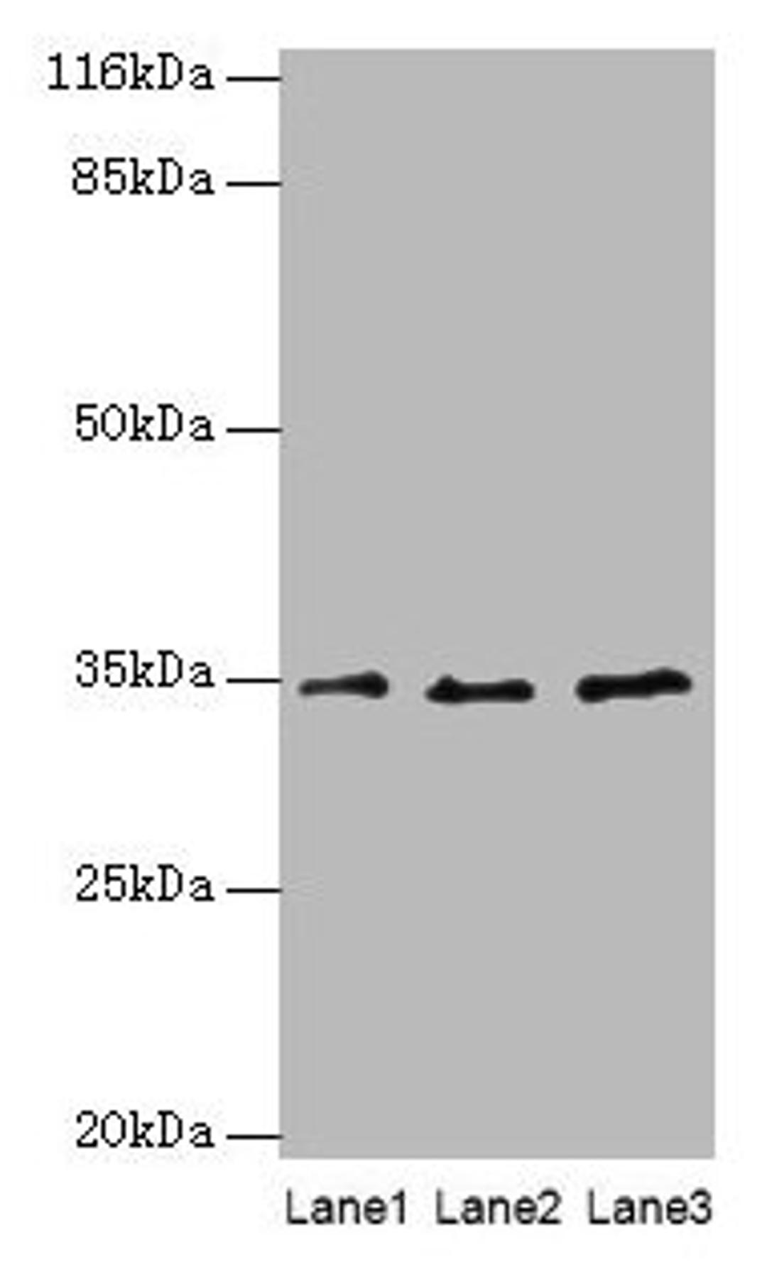 Western blot. All lanes: AZGP1 antibody at 4µg/ml. Lane 1: PC-3 whole cell lysate. Lane 2: HepG2 whole cell lysate. Lane 3: K562 whole cell lysate. Secondary. Goat polyclonal to rabbit IgG at 1/10000 dilution. Predicted band size: 35 kDa. Observed band size: 35 kDa