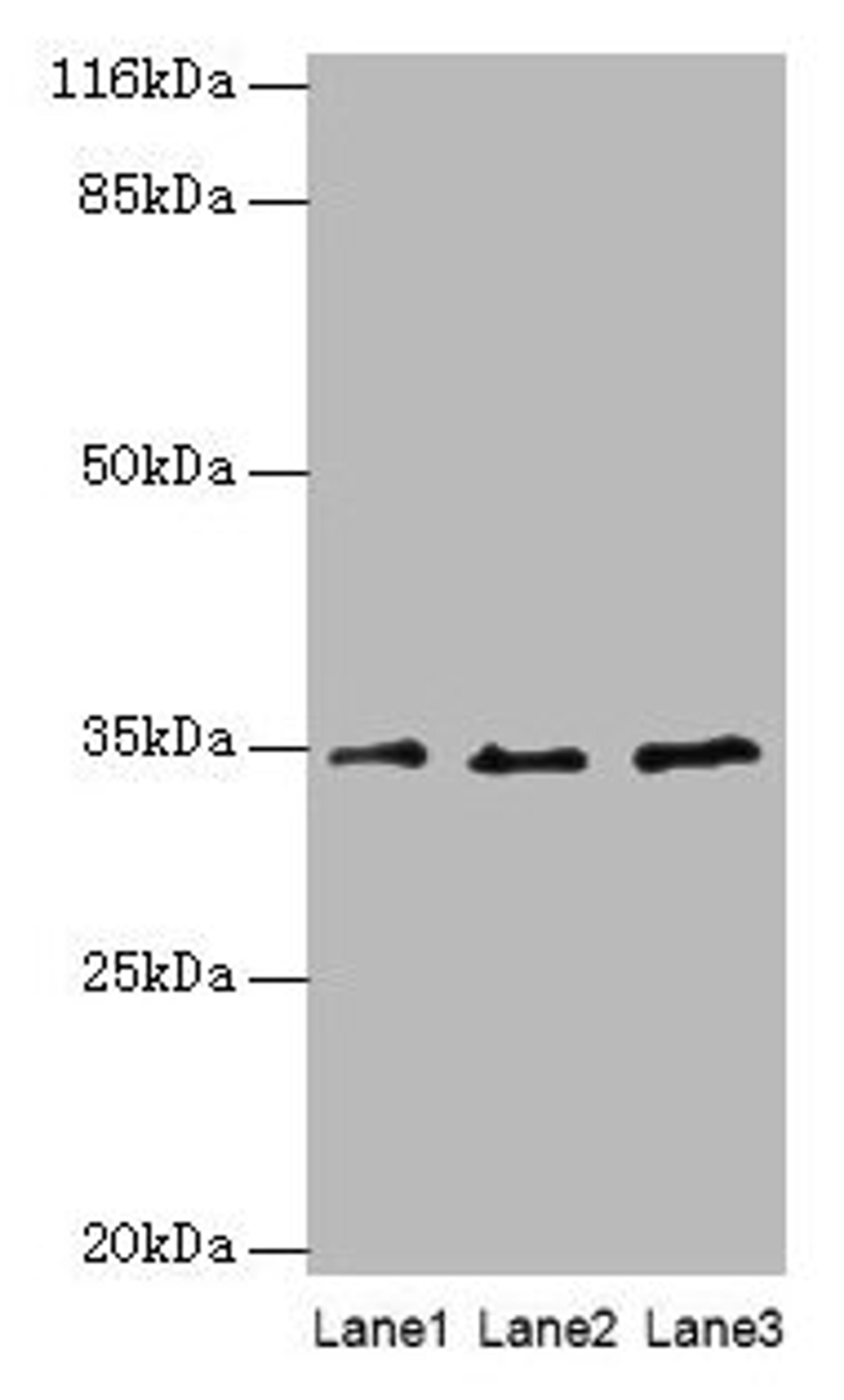Western blot. All lanes: AZGP1 antibody at 4µg/ml. Lane 1: PC-3 whole cell lysate. Lane 2: HepG2 whole cell lysate. Lane 3: K562 whole cell lysate. Secondary. Goat polyclonal to rabbit IgG at 1/10000 dilution. Predicted band size: 35 kDa. Observed band size: 35 kDa