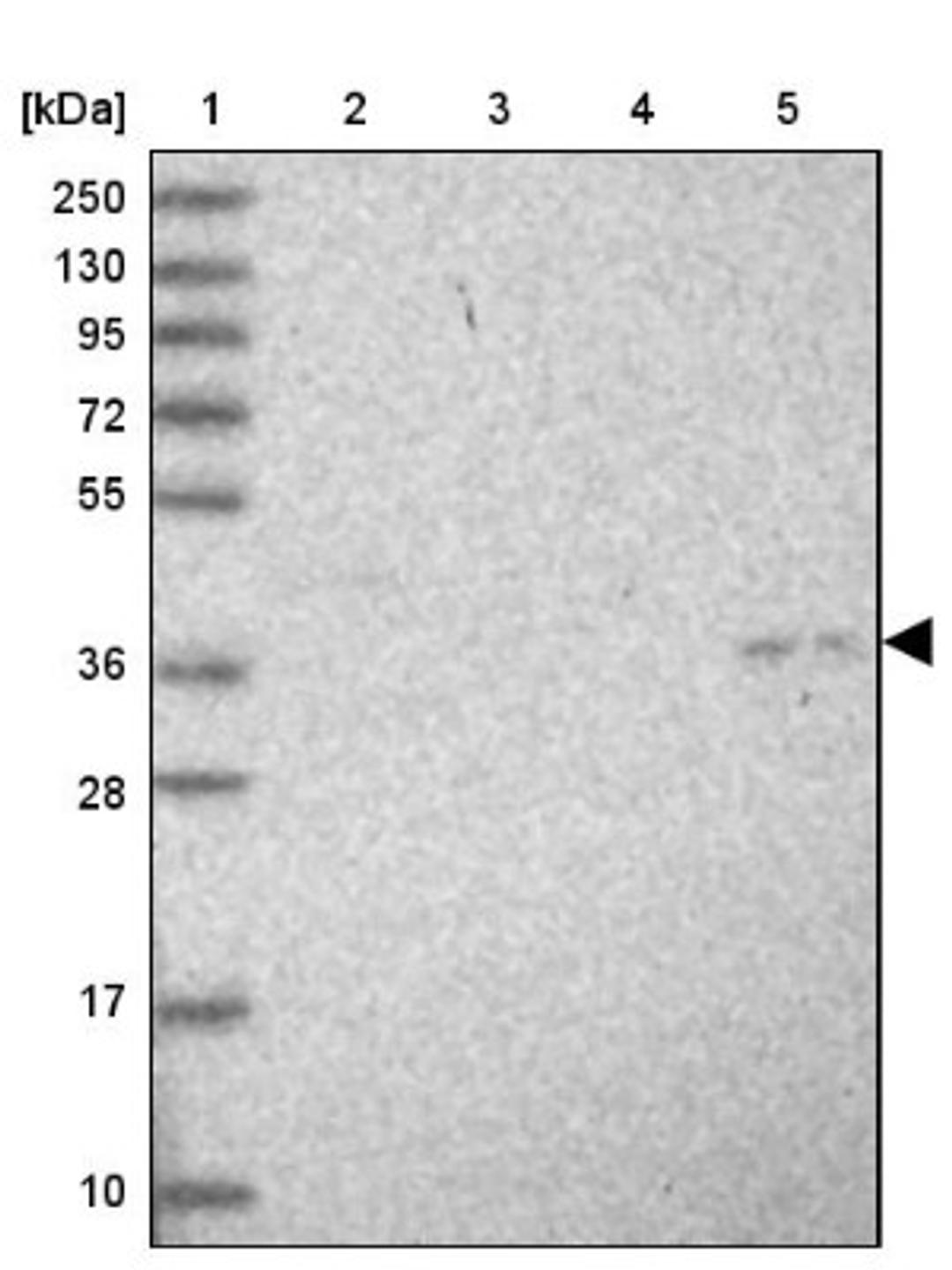 Western Blot: COQ9 Antibody [NBP1-88450] - Lane 1: Marker [kDa] 250, 130, 95, 72, 55, 36, 28, 17, 10<br/>Lane 2: Human cell line RT-4<br/>Lane 3: Human cell line U-251MG sp<br/>Lane 4: Human plasma (IgG/HSA depleted)<br/>Lane 5: Human liver tissue