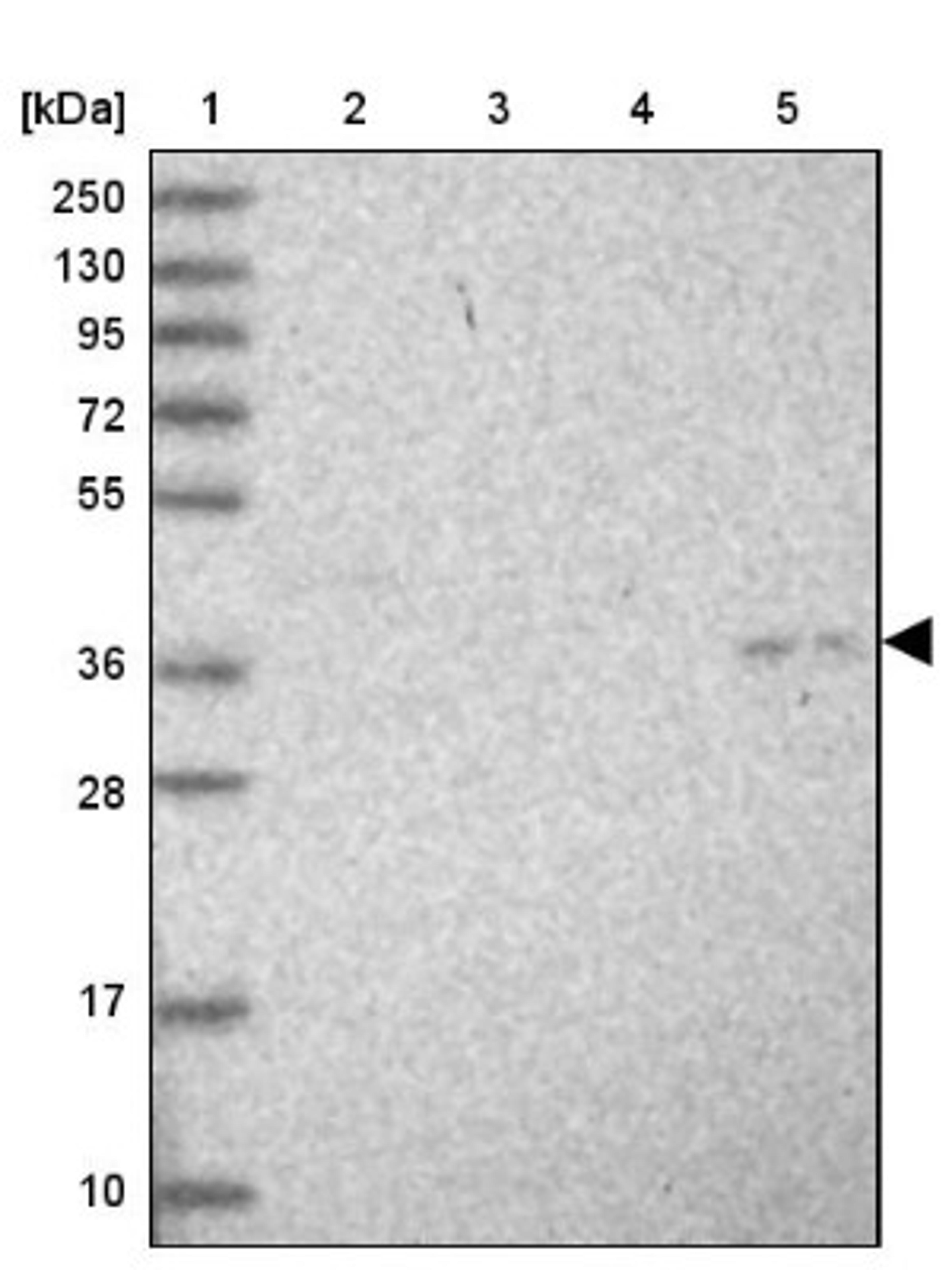 Western Blot: COQ9 Antibody [NBP1-88450] - Lane 1: Marker [kDa] 250, 130, 95, 72, 55, 36, 28, 17, 10<br/>Lane 2: Human cell line RT-4<br/>Lane 3: Human cell line U-251MG sp<br/>Lane 4: Human plasma (IgG/HSA depleted)<br/>Lane 5: Human liver tissue