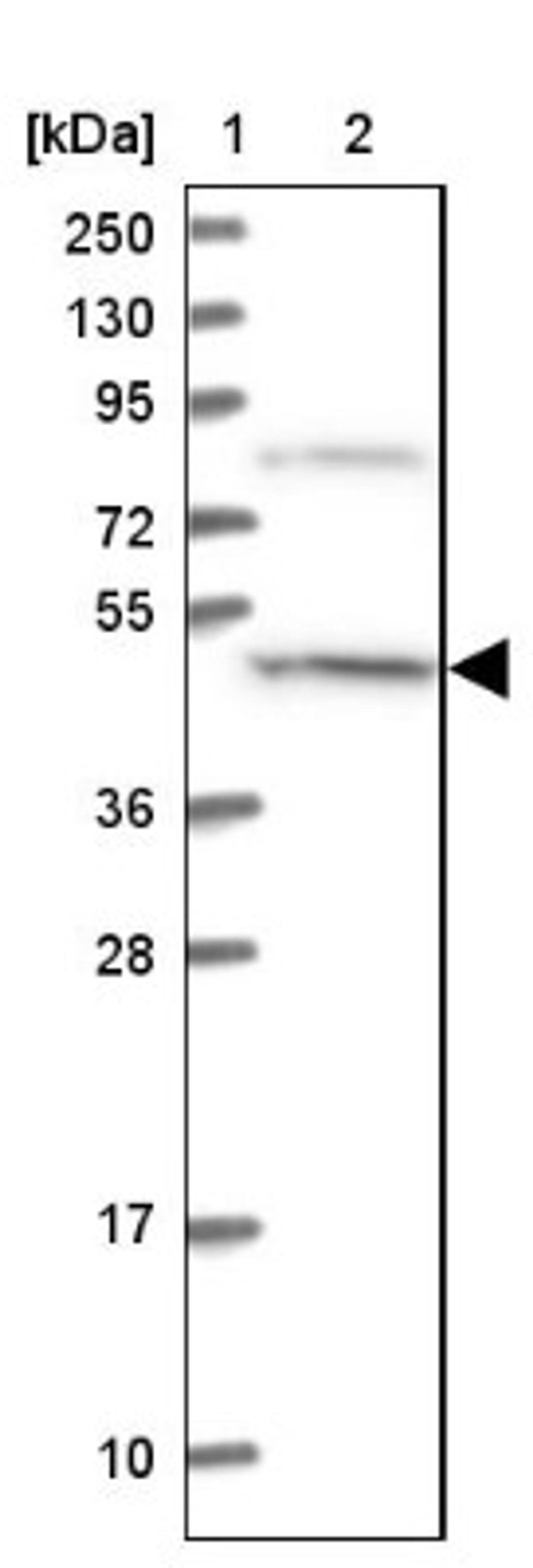 Western Blot: CCDC81 Antibody [NBP1-91763] - Lane 1: Marker [kDa] 250, 130, 95, 72, 55, 36, 28, 17, 10<br/>Lane 2: Human cell line RT-4