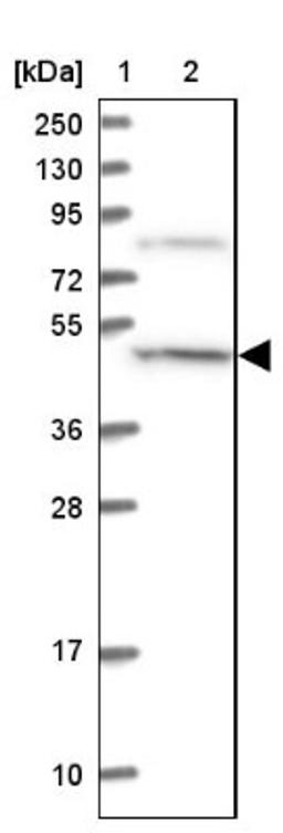 Western Blot: CCDC81 Antibody [NBP1-91763] - Lane 1: Marker [kDa] 250, 130, 95, 72, 55, 36, 28, 17, 10<br/>Lane 2: Human cell line RT-4