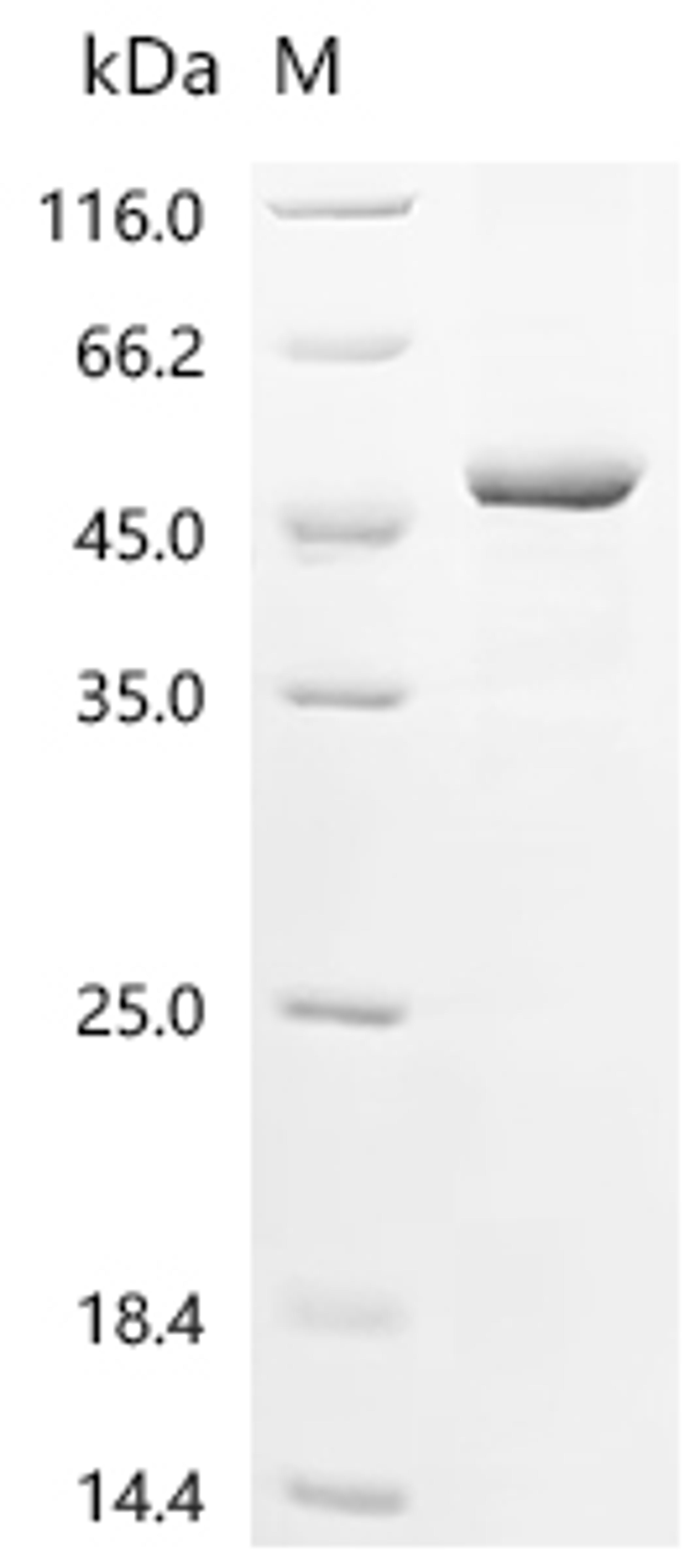 (Tris-Glycine gel) Discontinuous SDS-PAGE (reduced) with 5% enrichment gel and 15% separation gel.