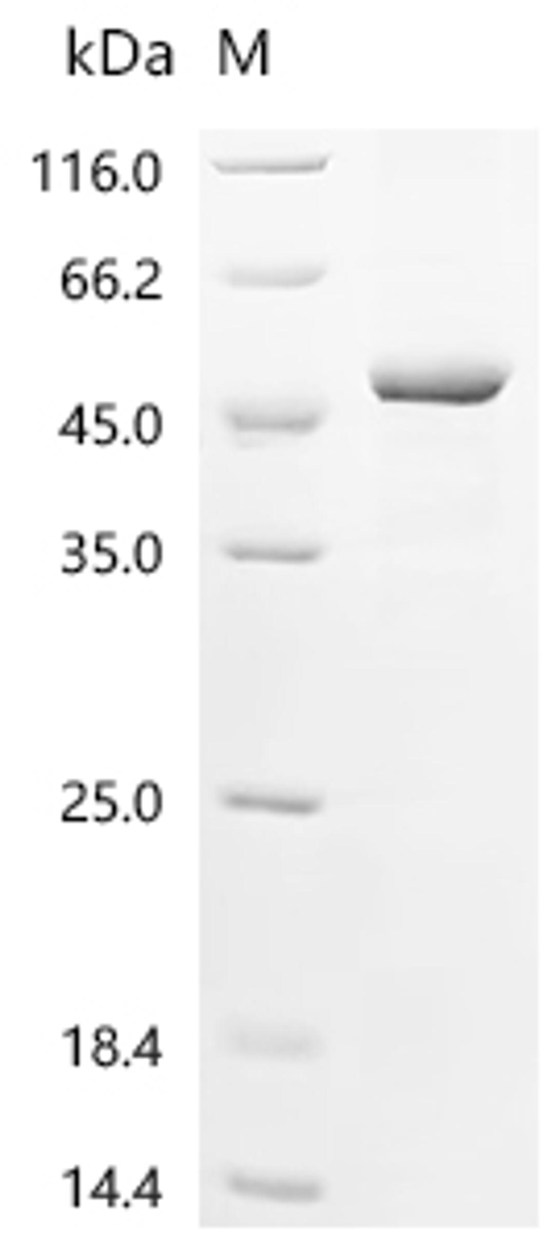 (Tris-Glycine gel) Discontinuous SDS-PAGE (reduced) with 5% enrichment gel and 15% separation gel.