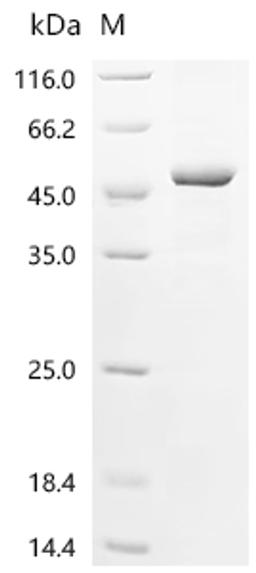 (Tris-Glycine gel) Discontinuous SDS-PAGE (reduced) with 5% enrichment gel and 15% separation gel.